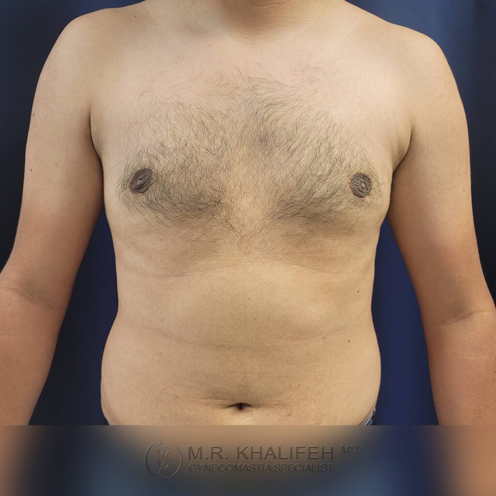 1656016968 post 5 5 scaled 1.jpg