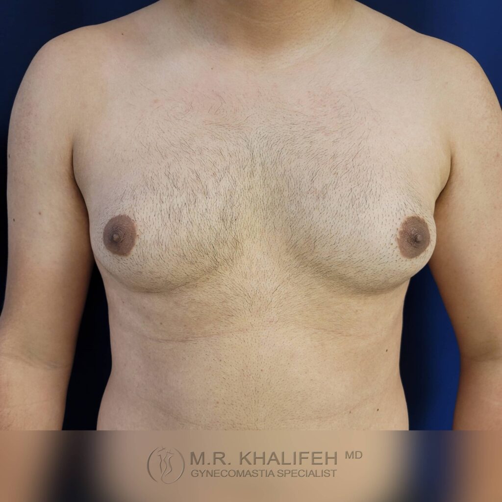 1656016973 pre 5 5 scaled 1.jpg