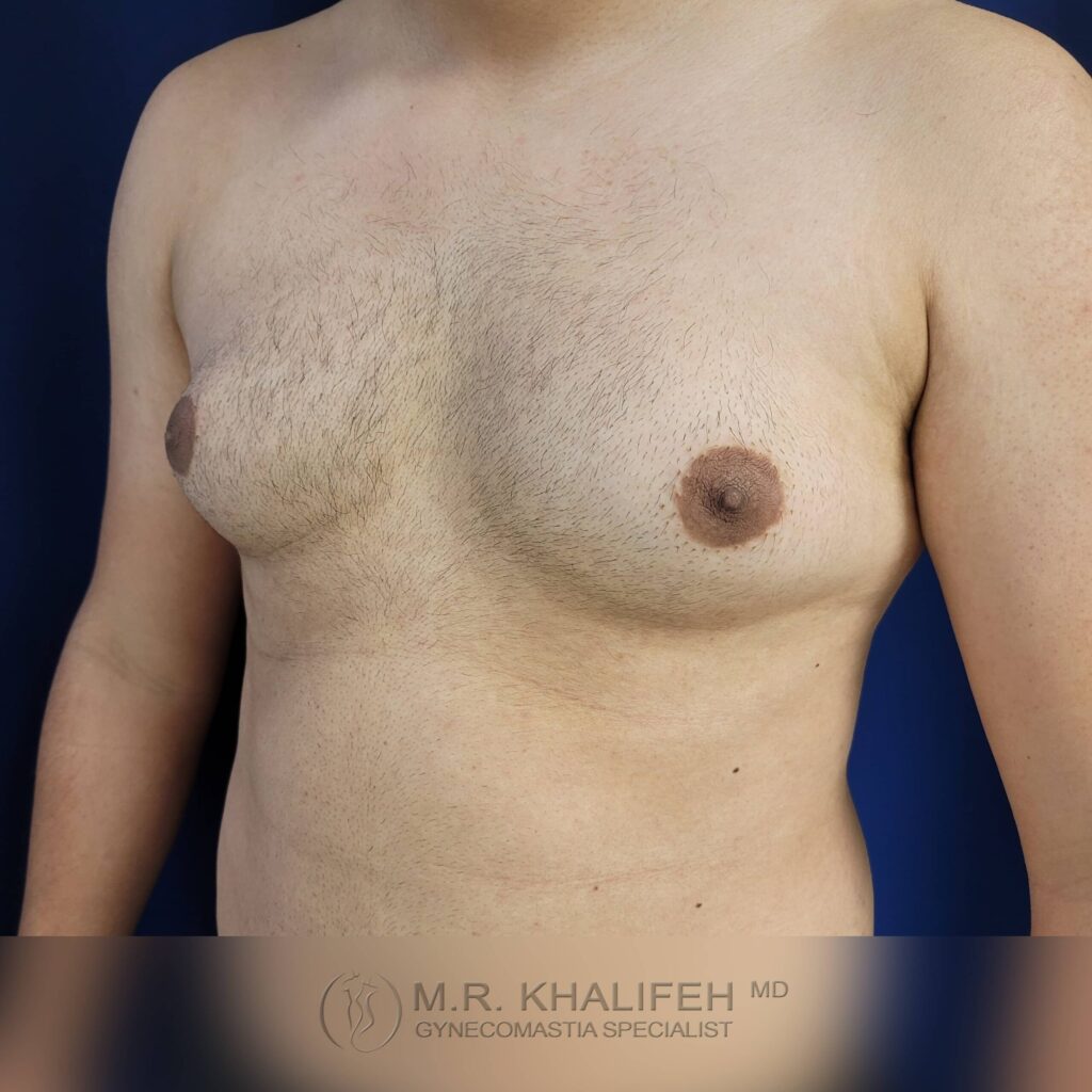 1656016978 pre 6 1 scaled 1.jpg