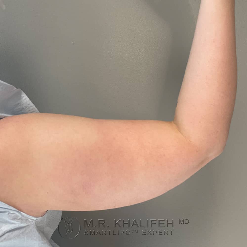 1656103938 pre 2.jpg