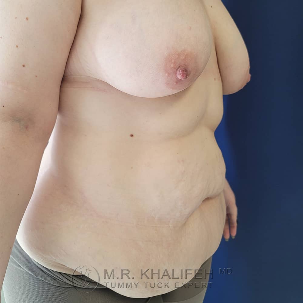 1656104042 pre 2.jpg