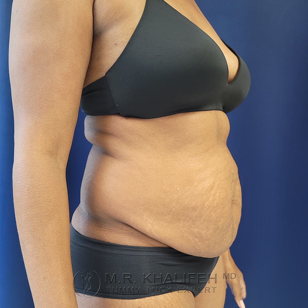 1658886148 pre 3 1.jpg