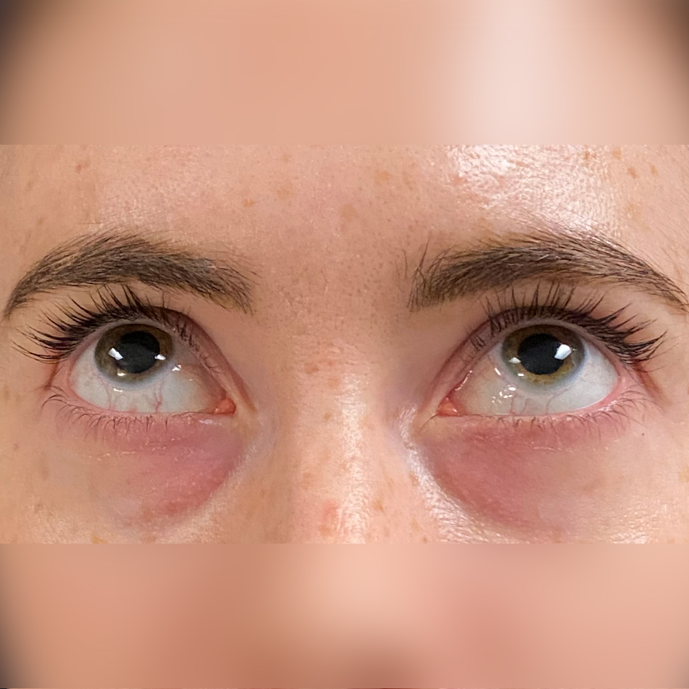 1659477476 pre 1 10.jpg