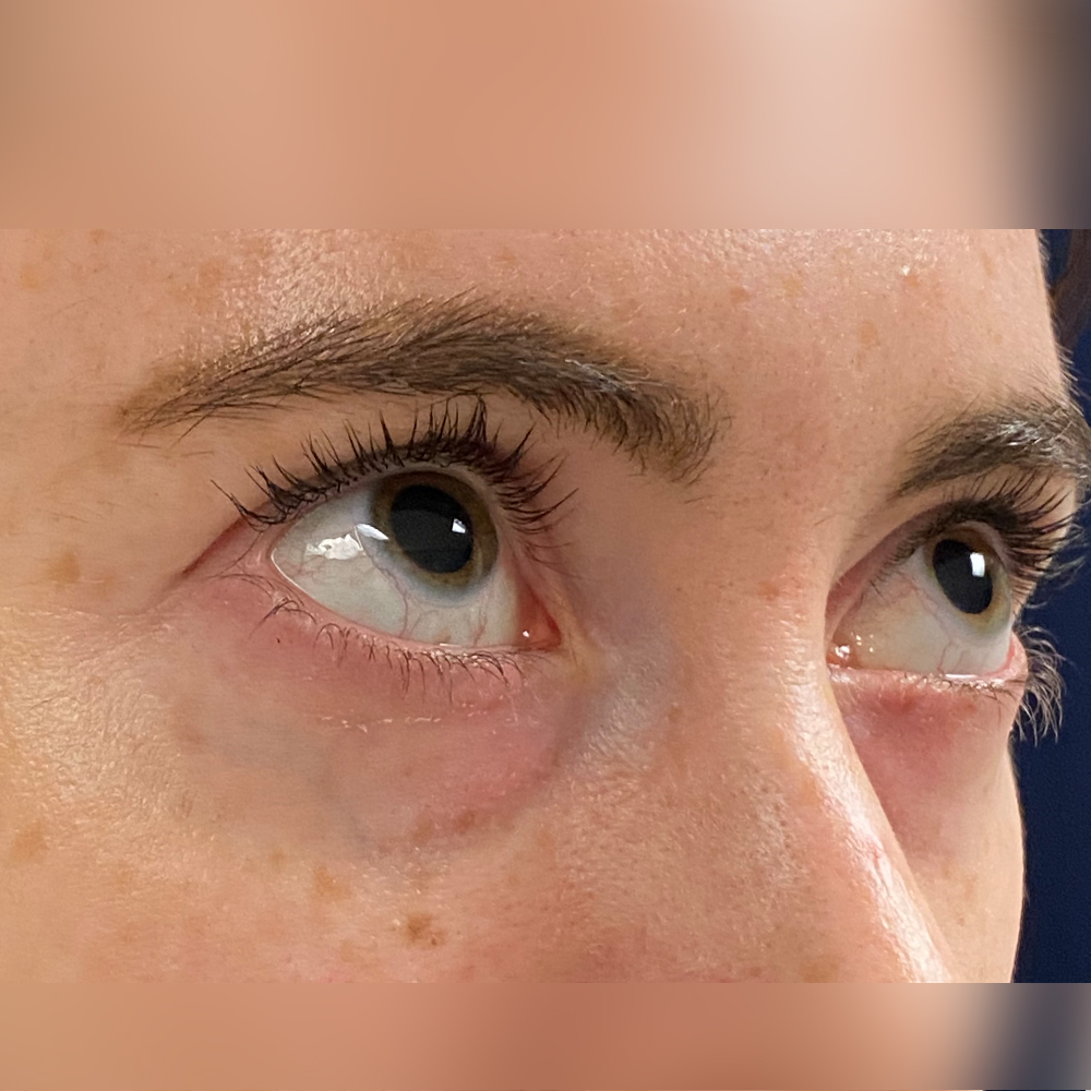 1659477491 pre 2 11.jpg