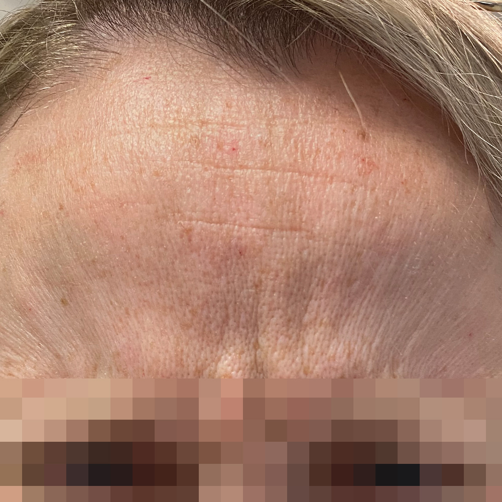 1659478559 pre 2 15.jpg