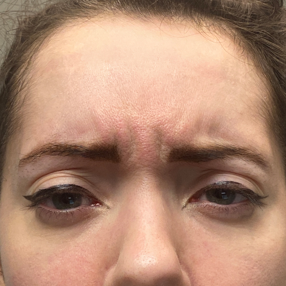 1659647295 pre 1 1.jpg