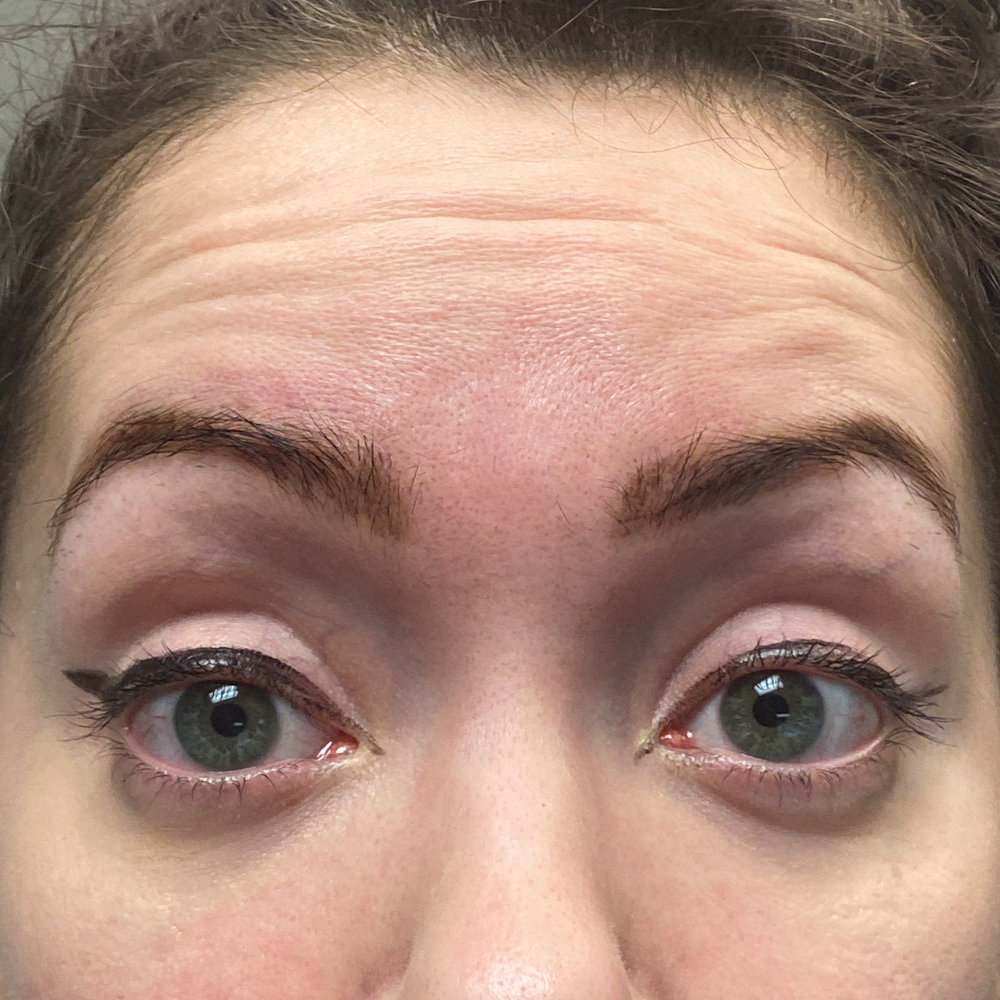 1659647308 pre 2 1.jpg