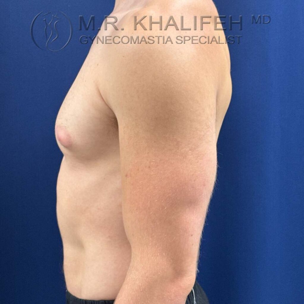 3 left side before.jpg