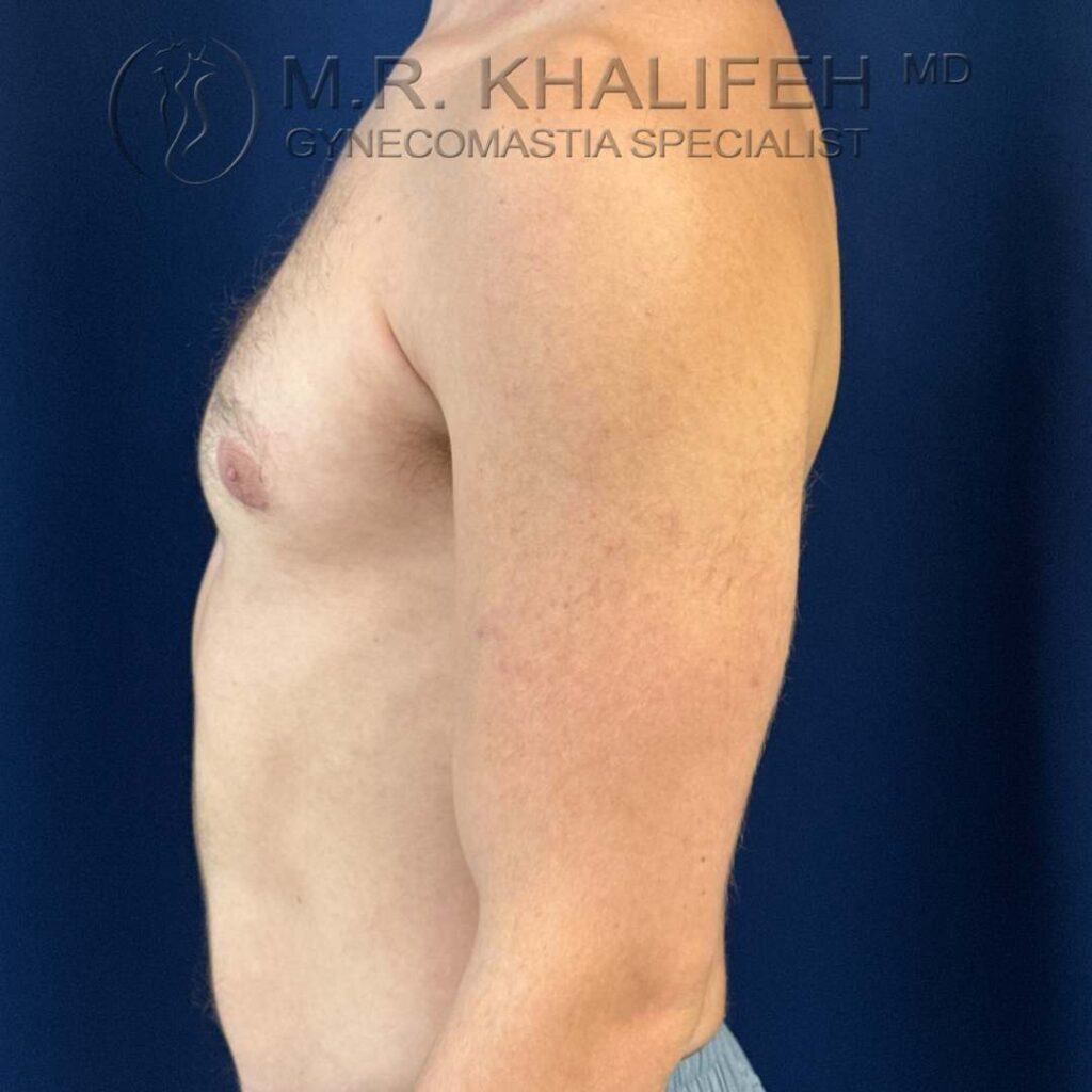 4 left side after.jpg