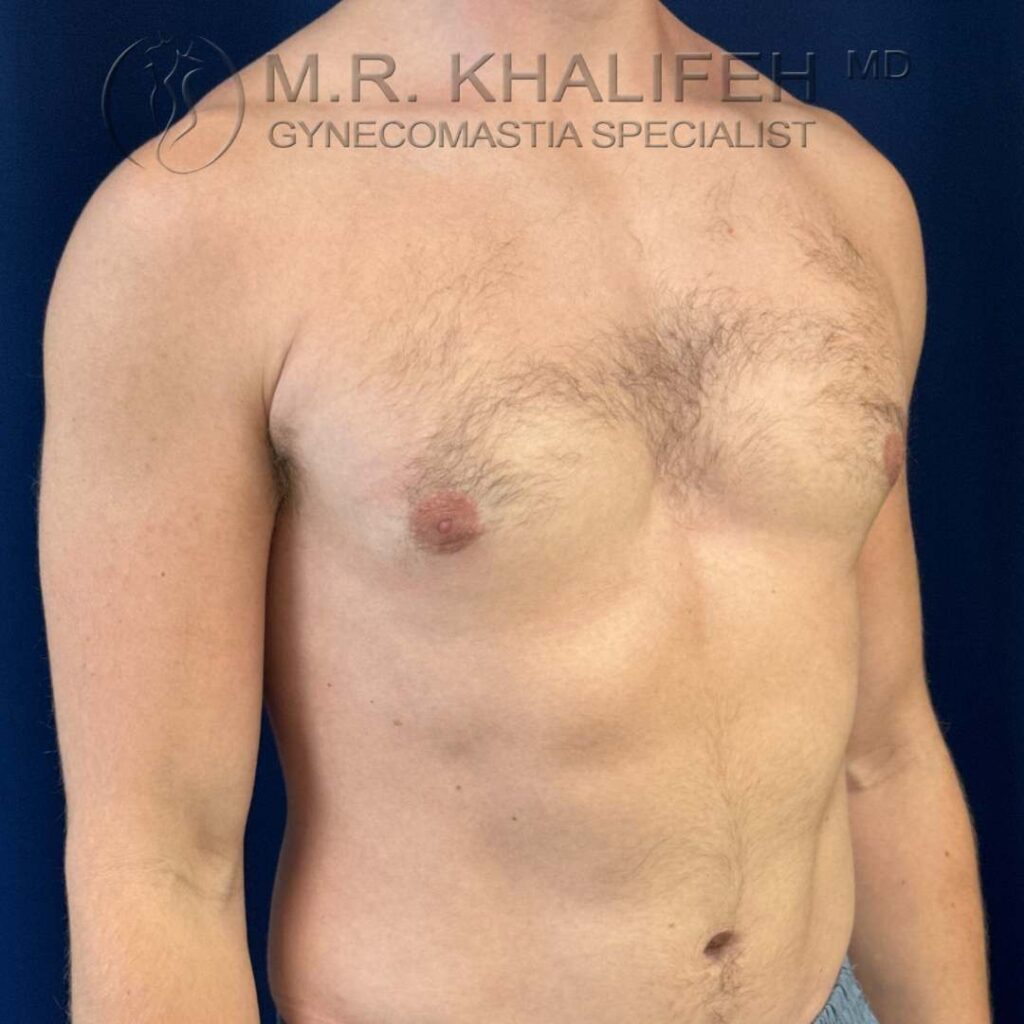 6 three quater side view right after.jpg