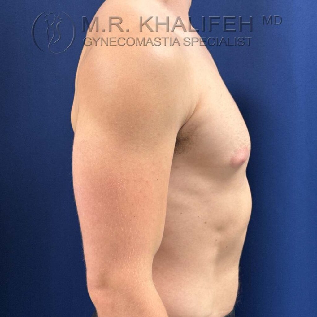 7 right side before.jpg