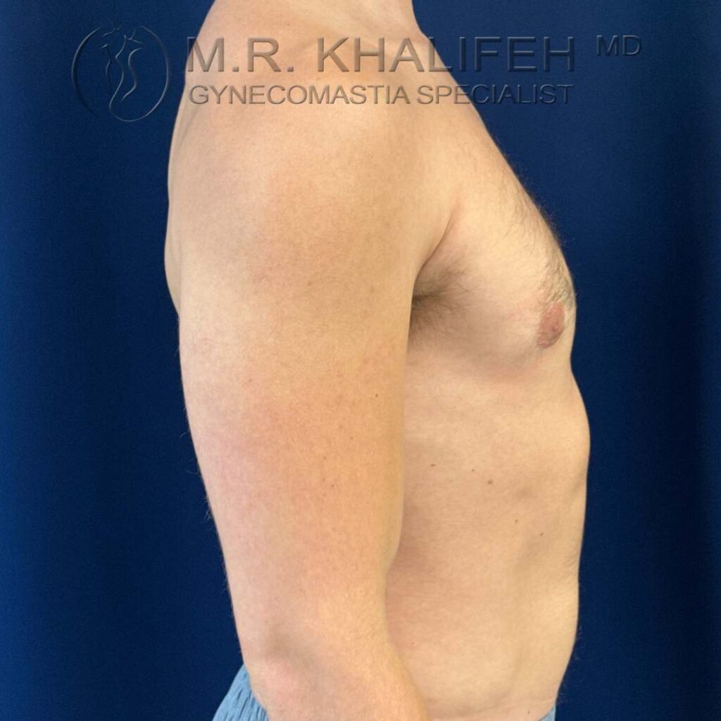 8 right side after.jpg