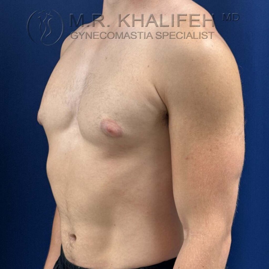 9 three quater side view left before.jpg