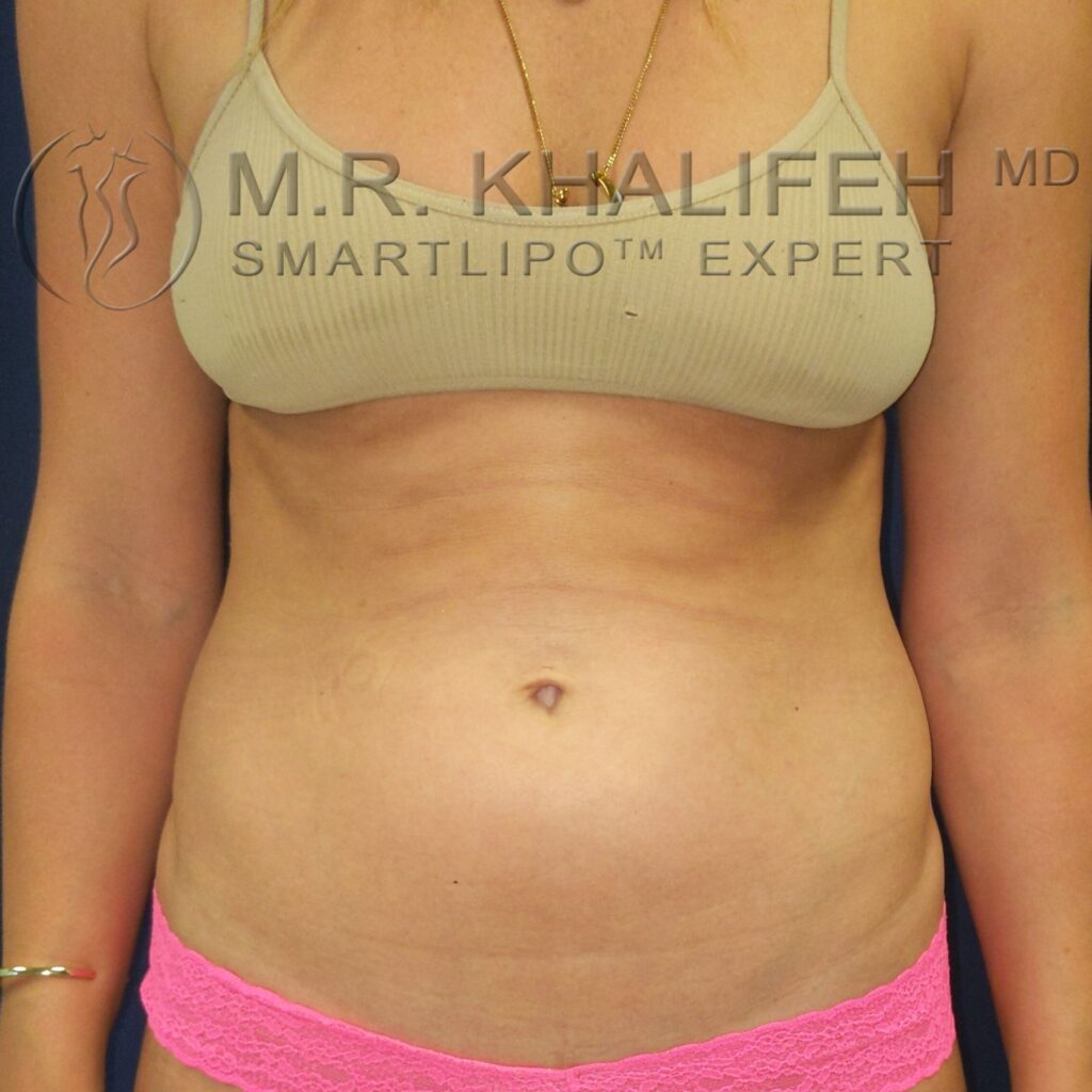 Untitled design 2 1.jpg