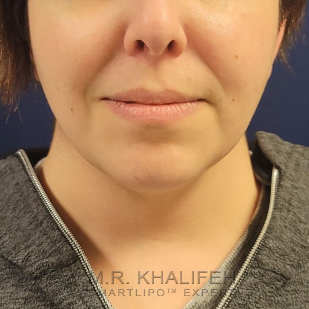 Xr:d:DAFWJoAC9mE:3,j:44363321891,t:22122915