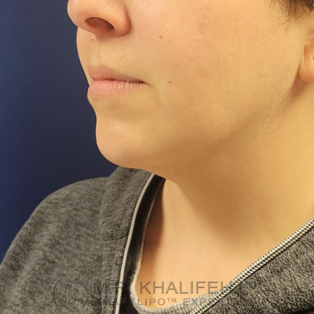 Xr:d:DAFWJmPiIFI:3,j:44363327239,t:22122915