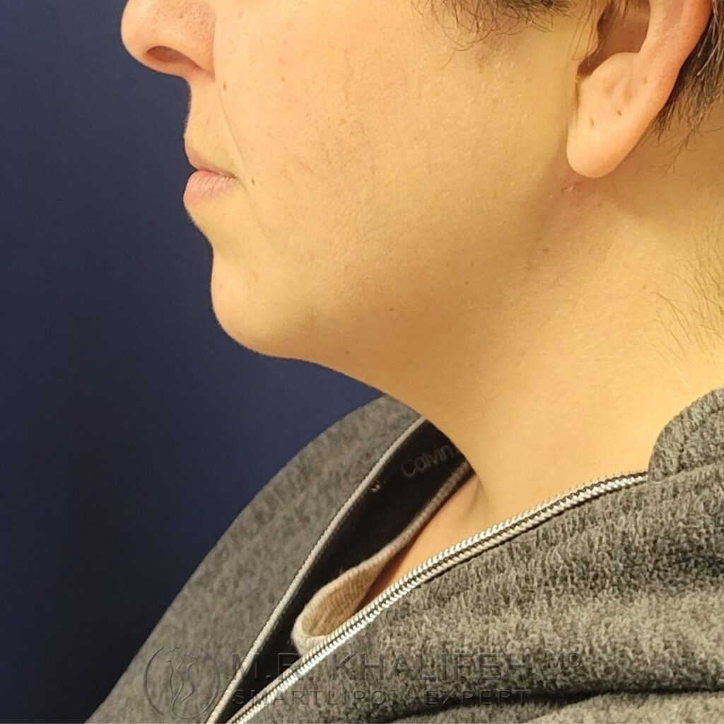 Xr:d:DAFWJgaWxW8:3,j:1120169010,t:22122915