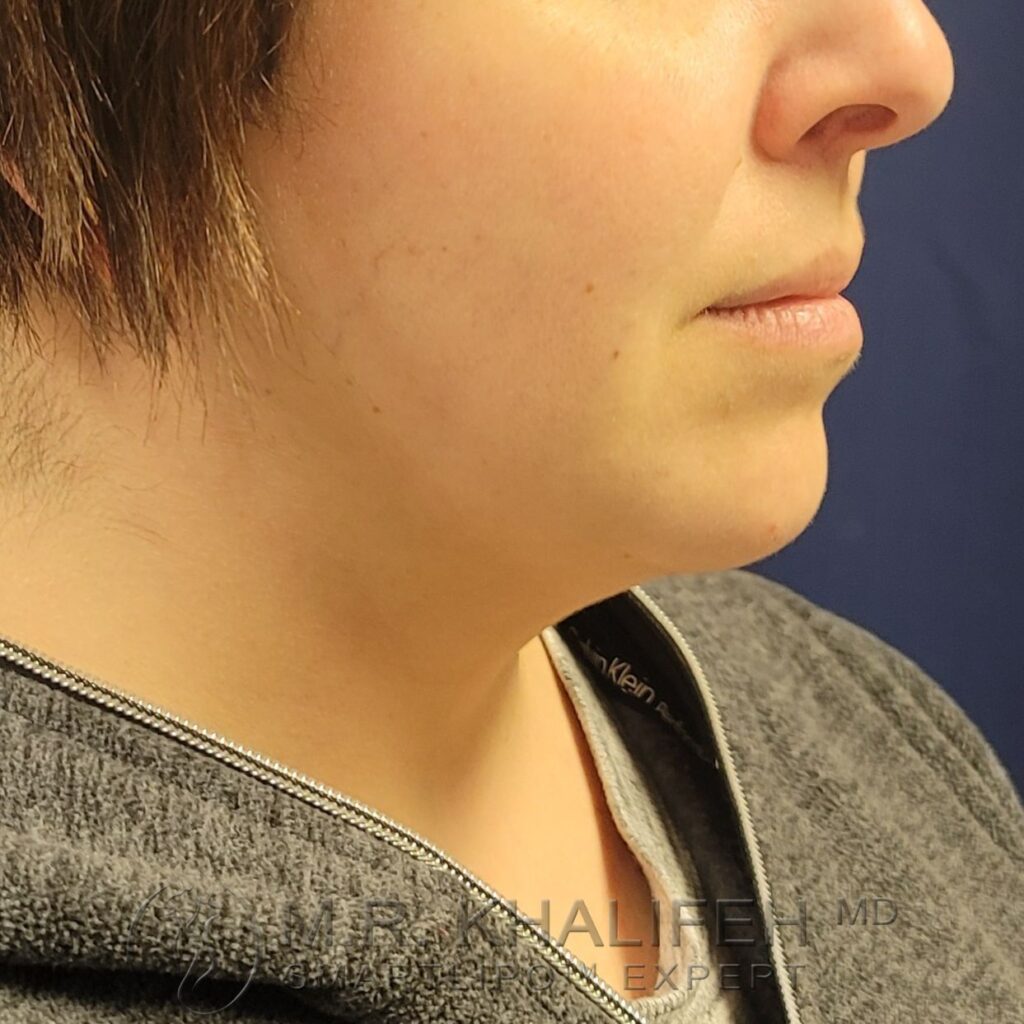 Xr:d:DAFWJviixKY:3,j:44363344419,t:22122915