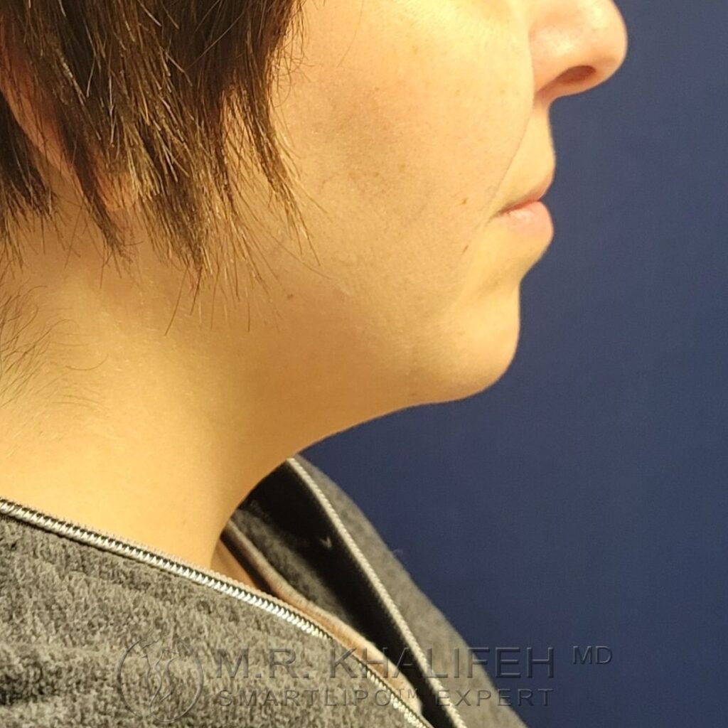 Xr:d:DAFWJr6PP24:3,j:1120185681,t:22122915