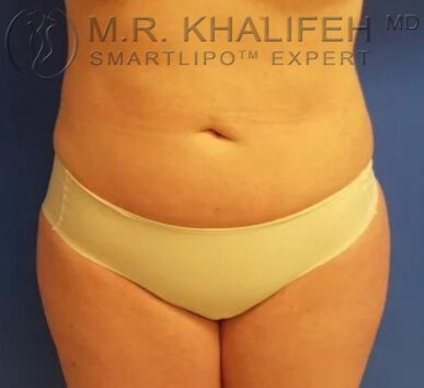 Untitled design 35 1.jpg