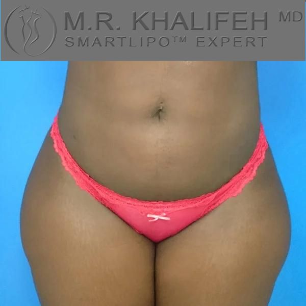 Untitled design 41 1.jpg