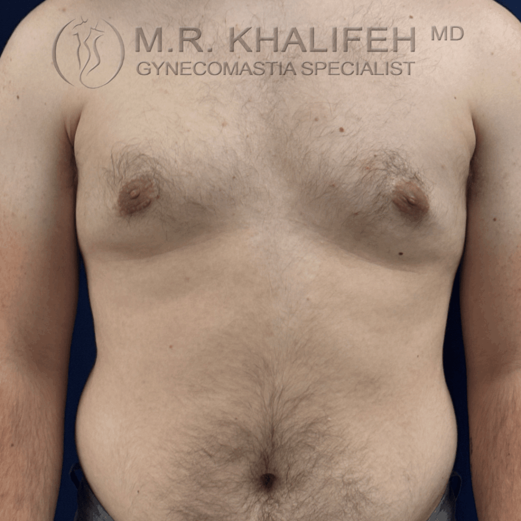 After front view.png