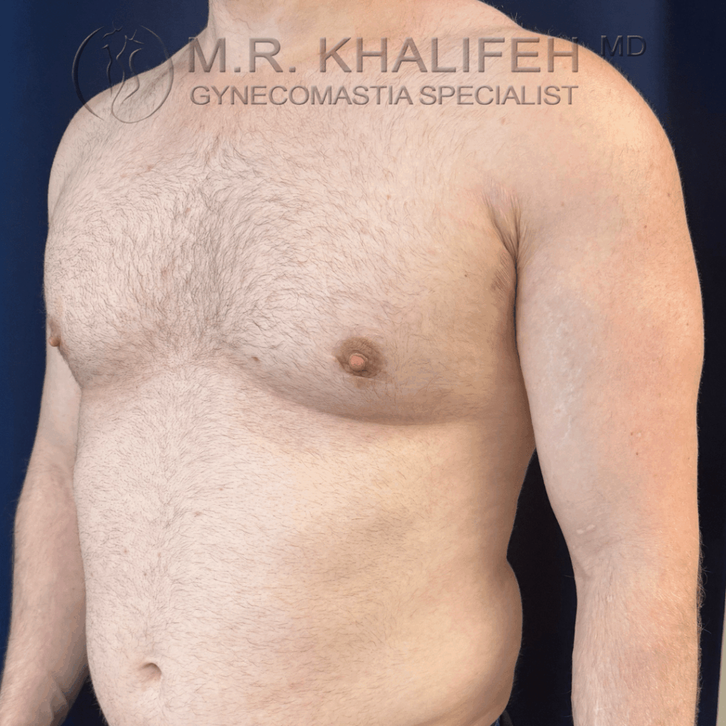 After half side view left.png