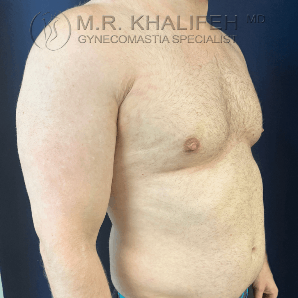 After half side view right.png