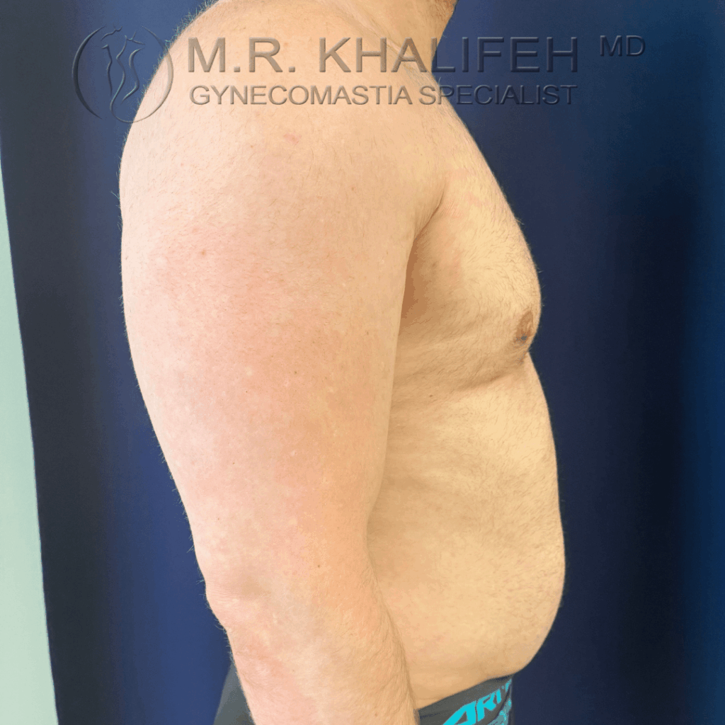 After side view right.png