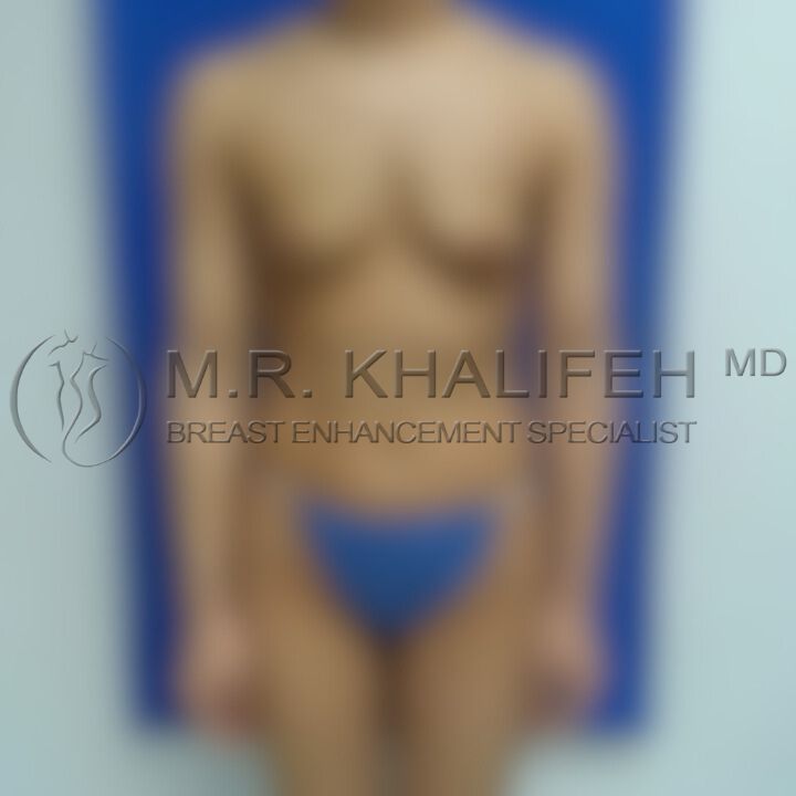 Fat before