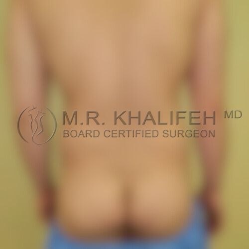 Male fat before