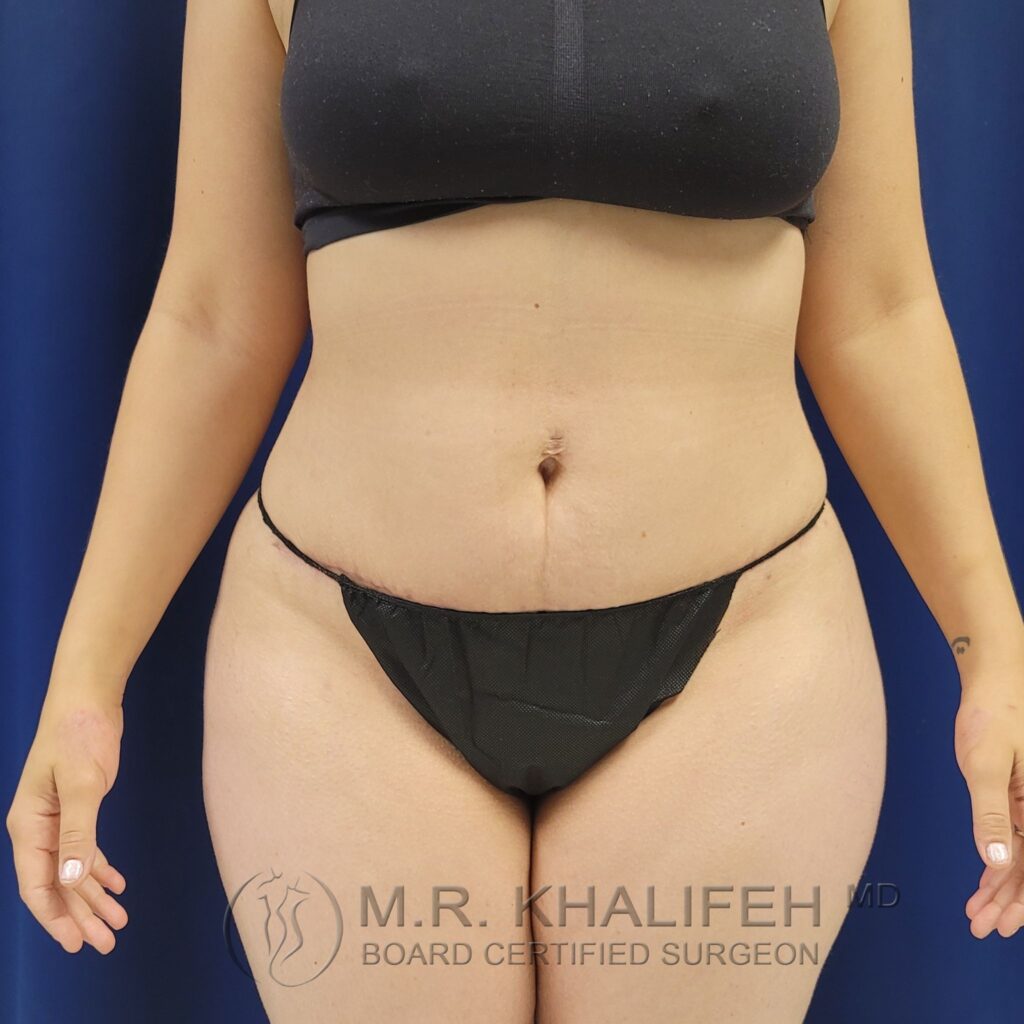 Xr:d:DAFQP7WMxe0:2,j:39252098064,t:22102715