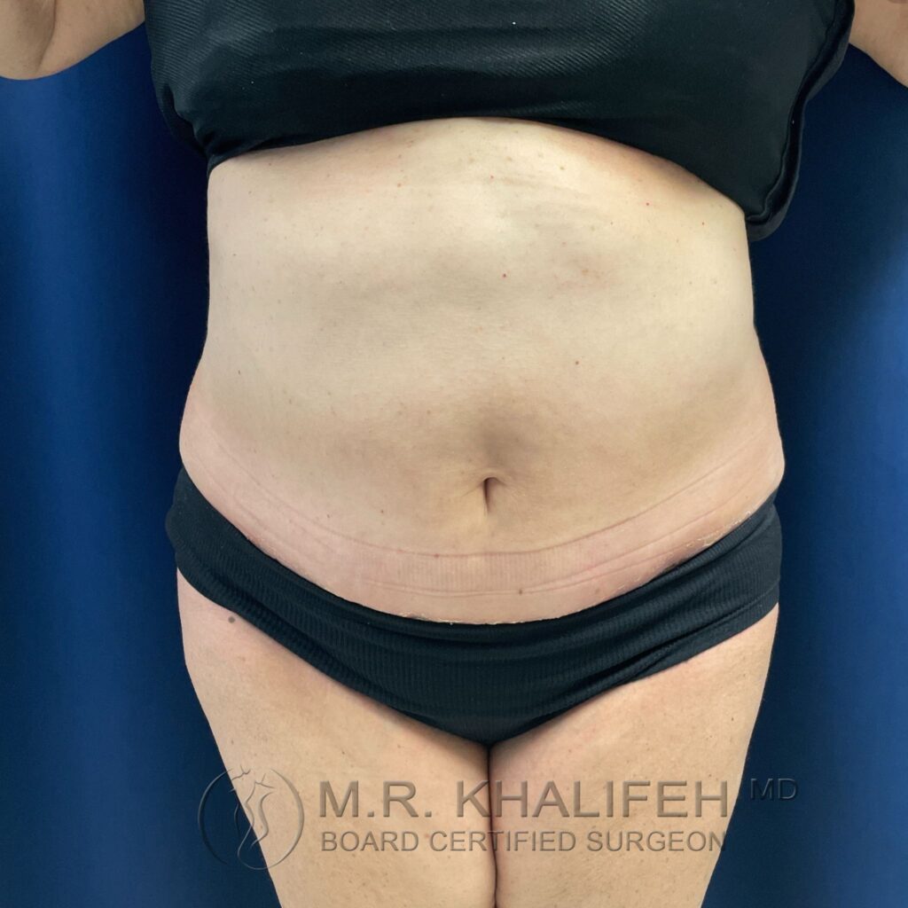 Xr:d:DAFQQbT2TDY:2,j:39259523662,t:22102717