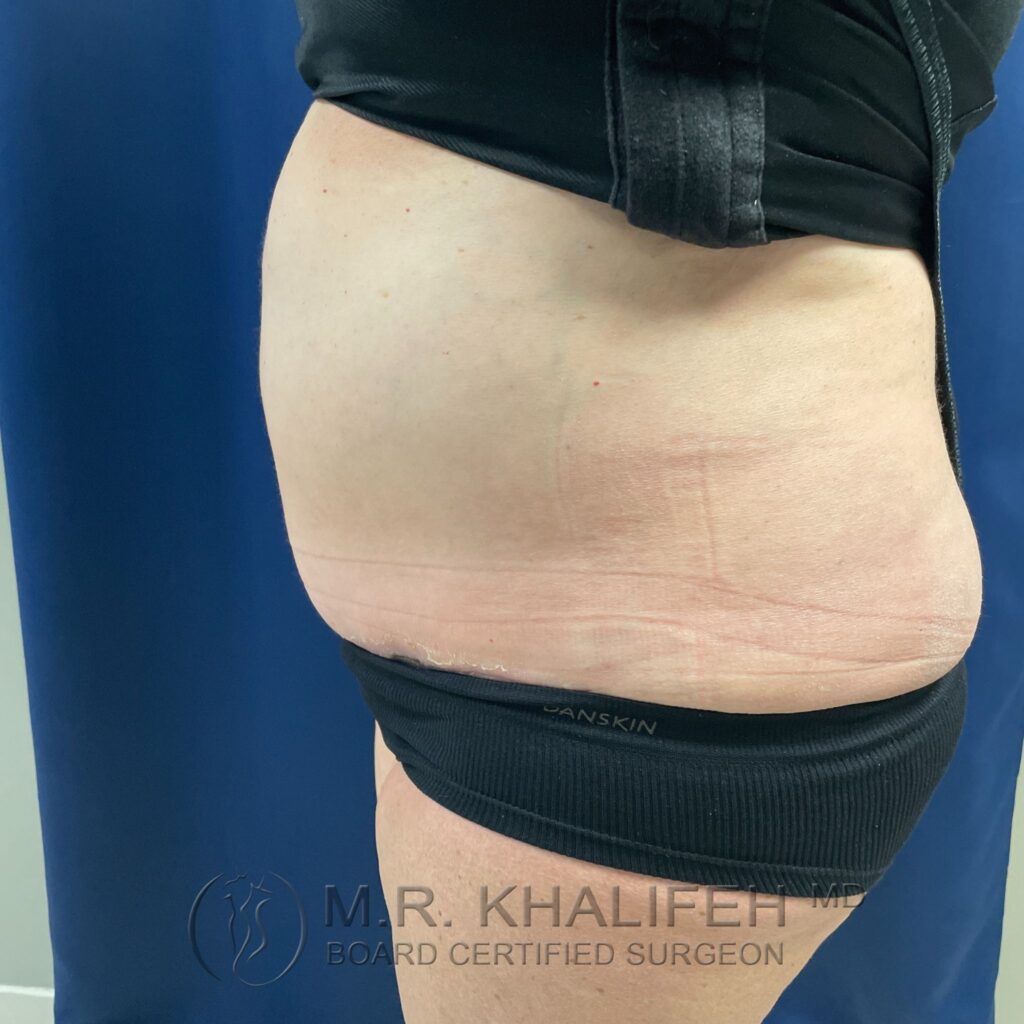 Xr:d:DAFQQTtowj4:2,j:39259434735,t:22102717