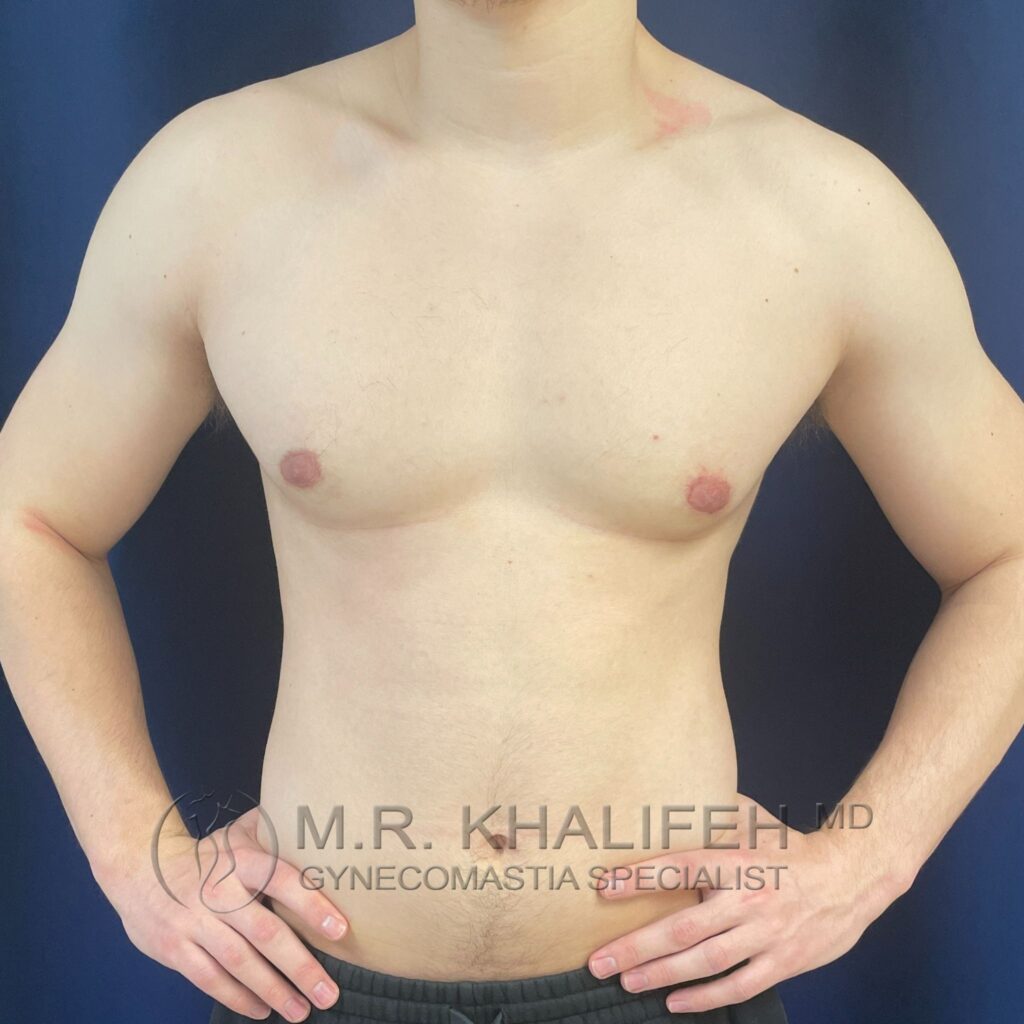 Xr:d:DAFYNq2ny3E:3,j:2262304620,t:23012014