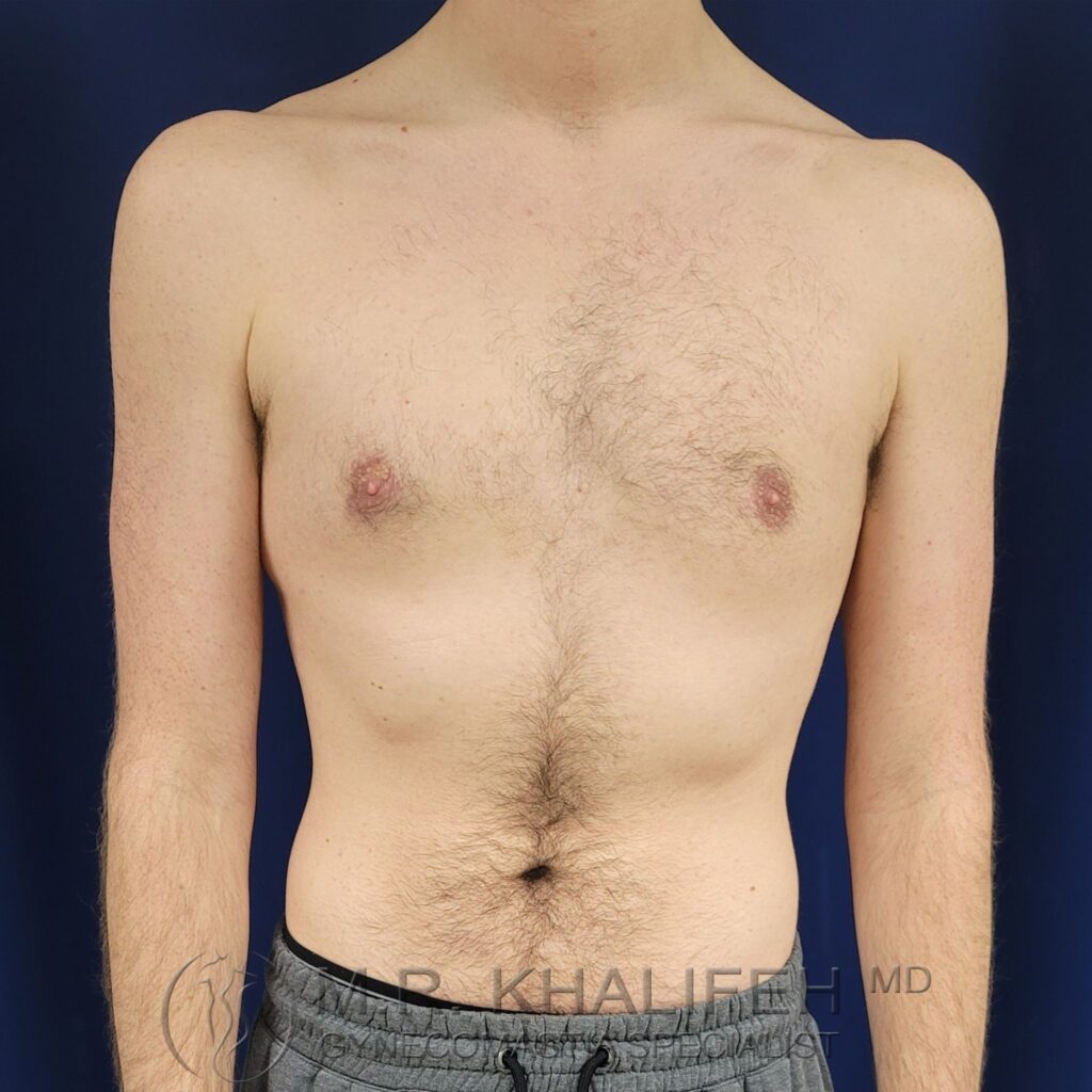 Xr:d:DAFWnxr1PCs:3,j:1337967282,t:23010315