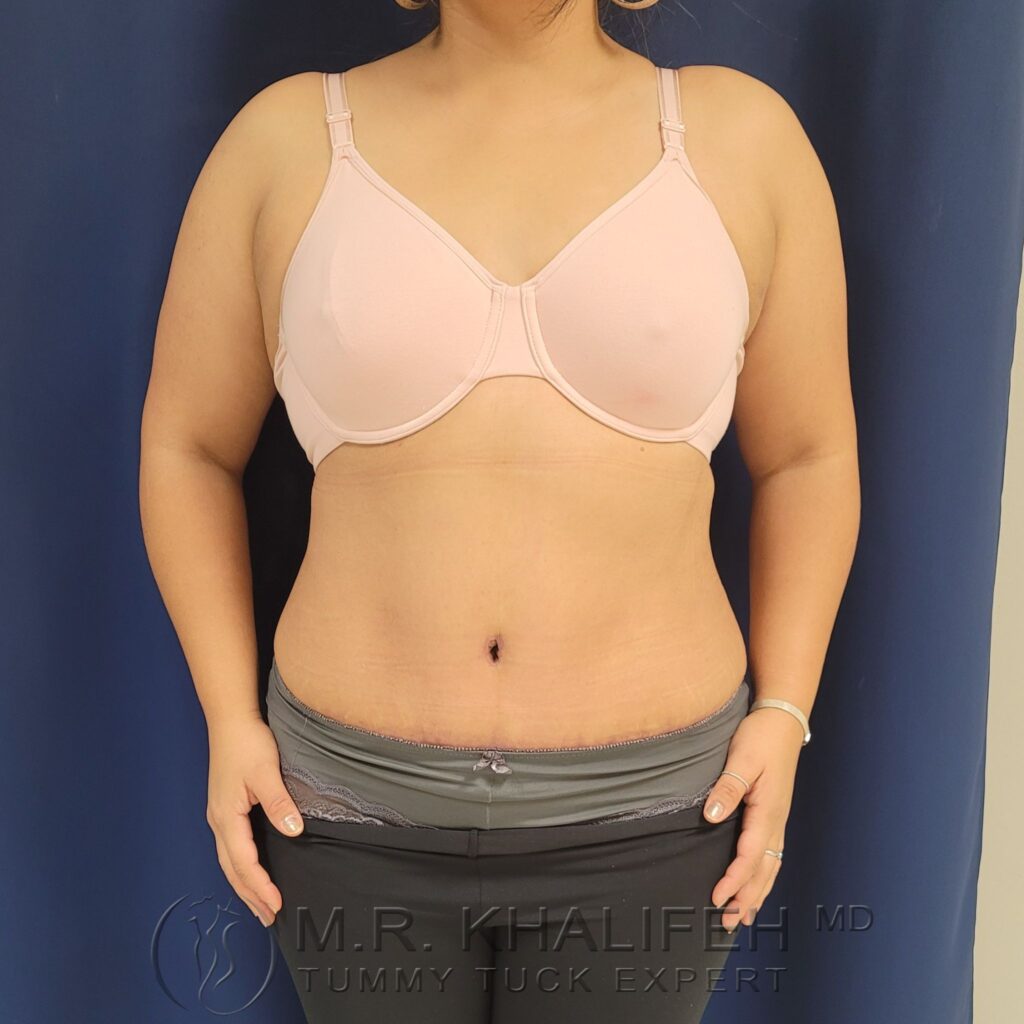 Xr:d:DAFWJsoa4zE:3,j:1118164412,t:22122914