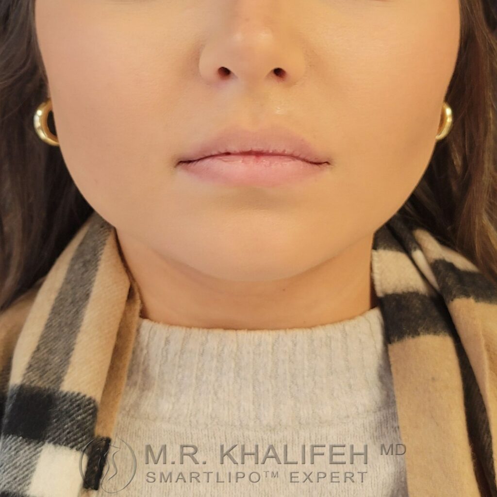 Xr:d:DAFVTy4ynwU:3,j:43951909509,t:22122015