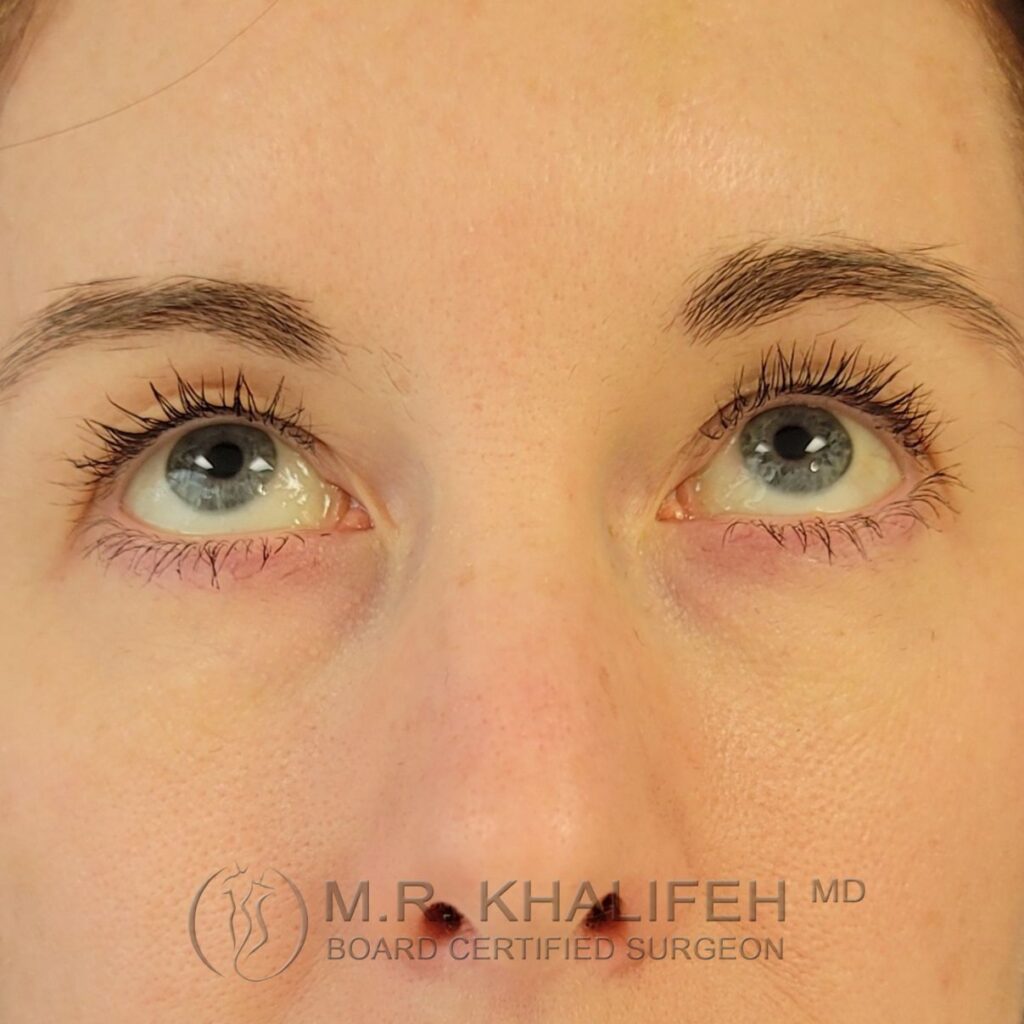 Xr:d:DAFU7piA1j4:2,j:43770614308,t:22121615