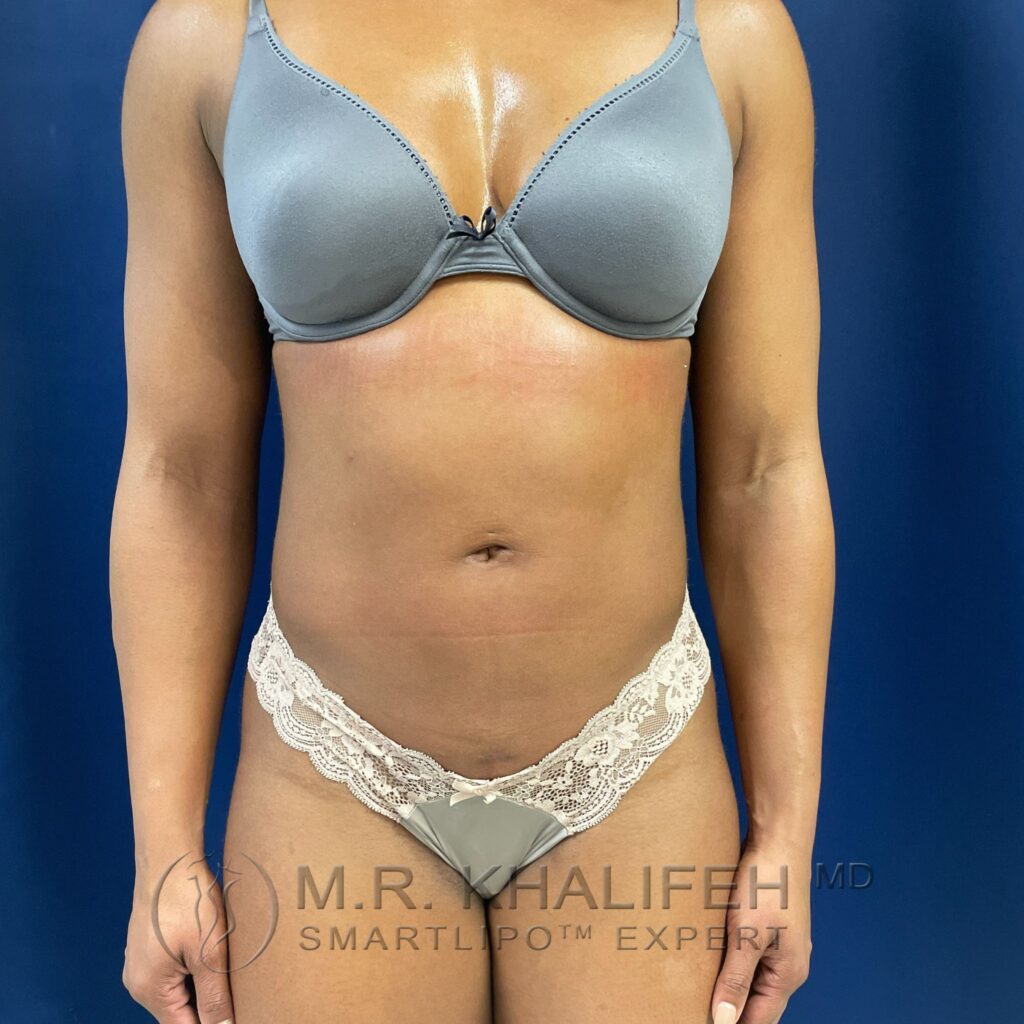 Xr:d:DAFYNqfTevA:3,j:45540933630,t:23012014