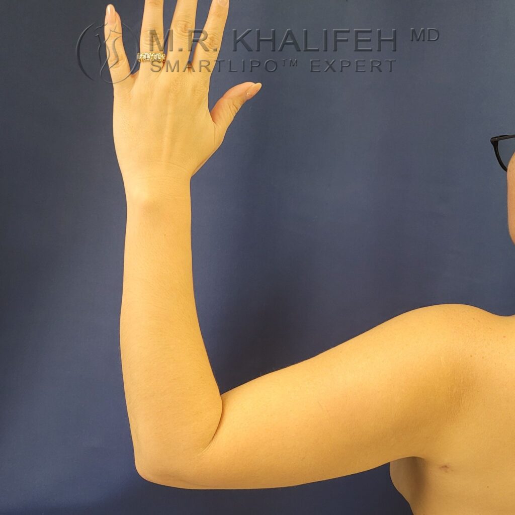 Xr:d:DAFYIMOGJEA:3,j:2211347509,t:23011916