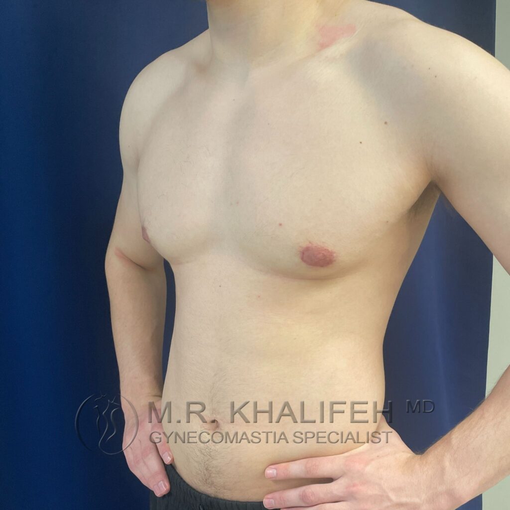 Xr:d:DAFYNo0lt2k:3,j:2262318993,t:23012014