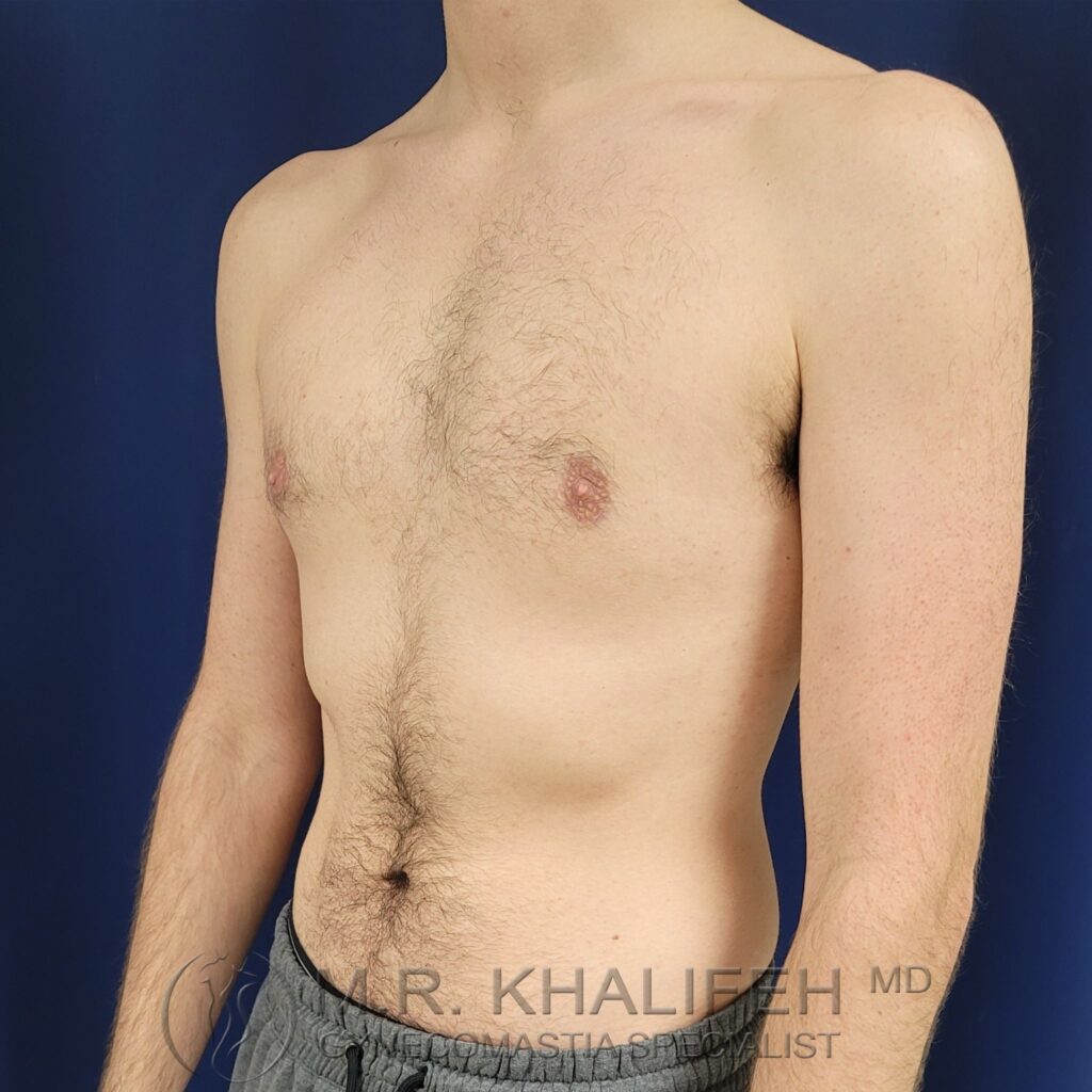 Xr:d:DAFWn9Mor2U:3,j:44588021576,t:23010315