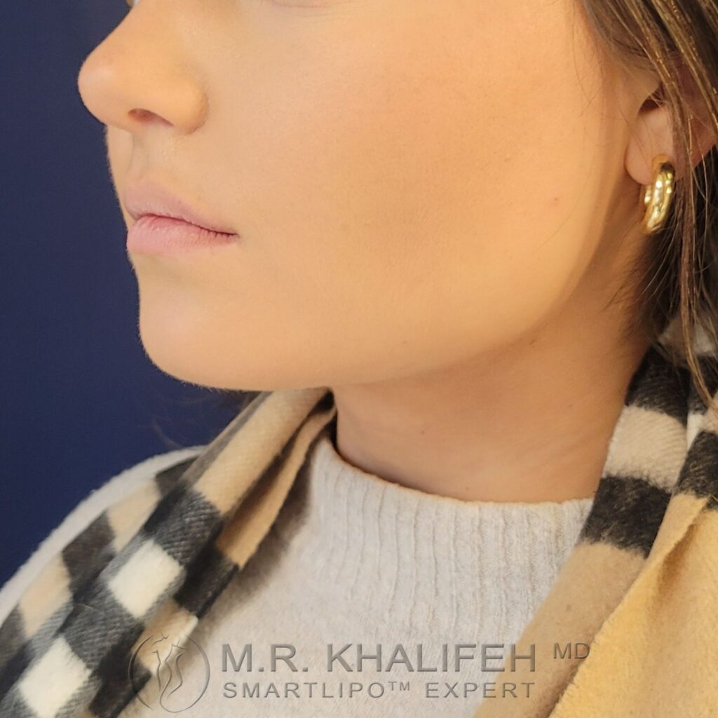 Xr:d:DAFVT7WfwjQ:3,j:43951919601,t:22122015