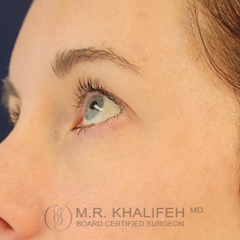 Xr:d:DAFU79jADjA:2,j:43770597864,t:22121615