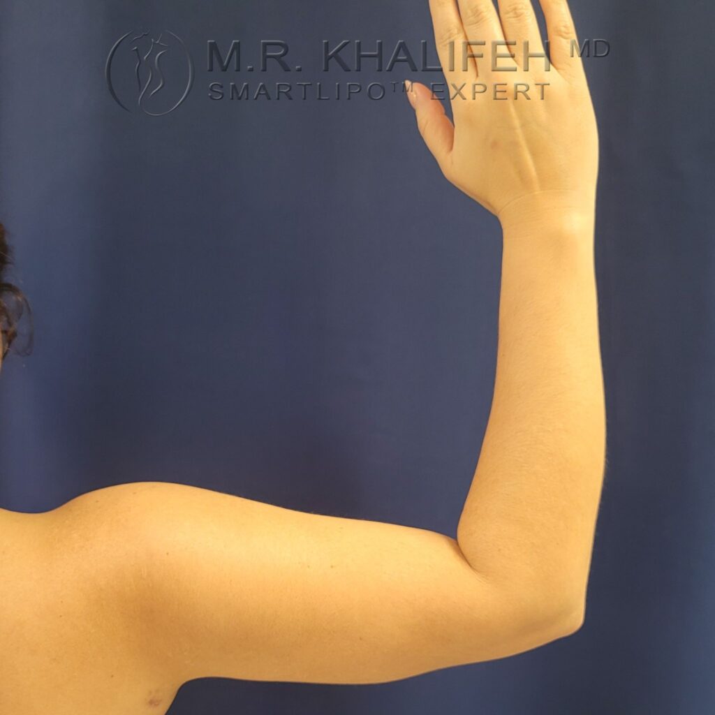 Xr:d:DAFYIJdQsUs:3,j:45486689397,t:23011916