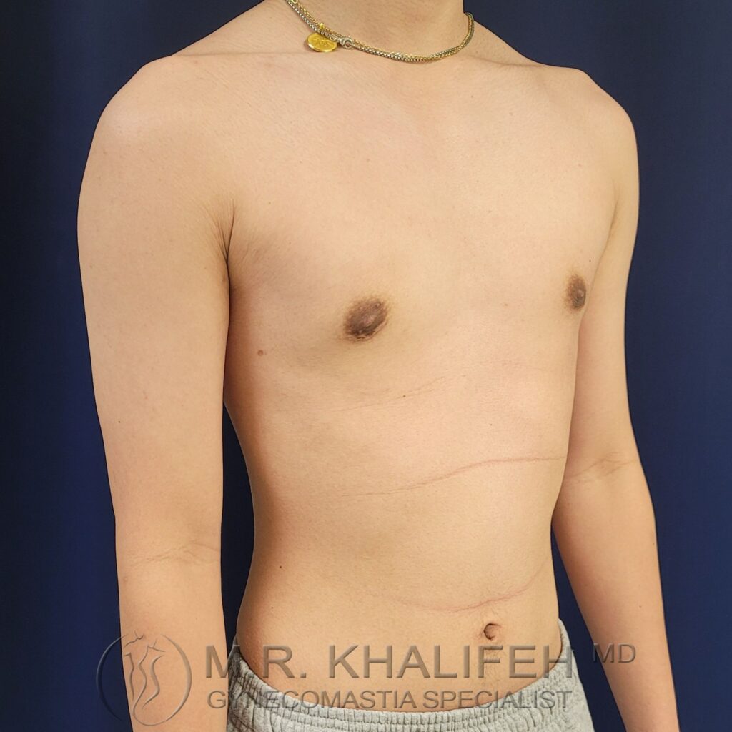 Xr:d:DAFV q6TA2s:3,j:1042512104,t:22122718