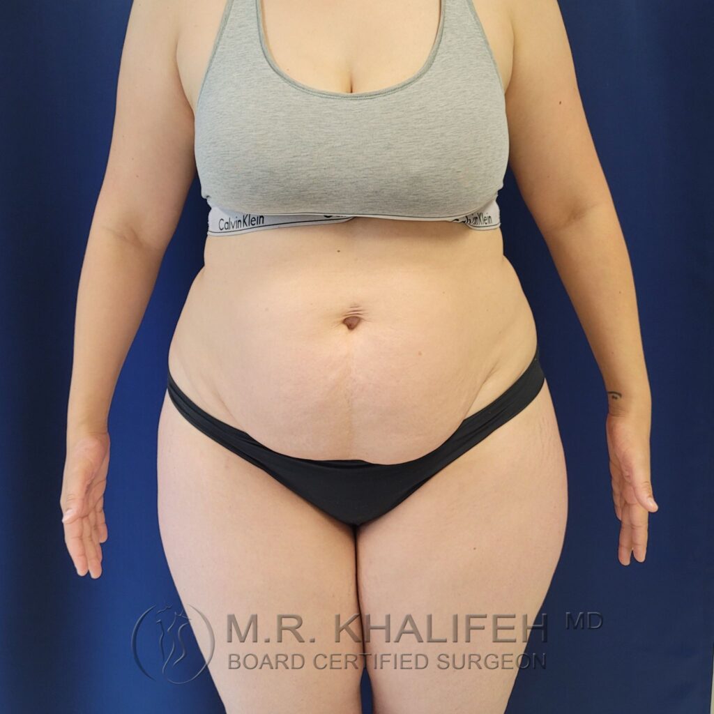 Xr:d:DAFQP C9Hbk:2,j:39252390753,t:22102715