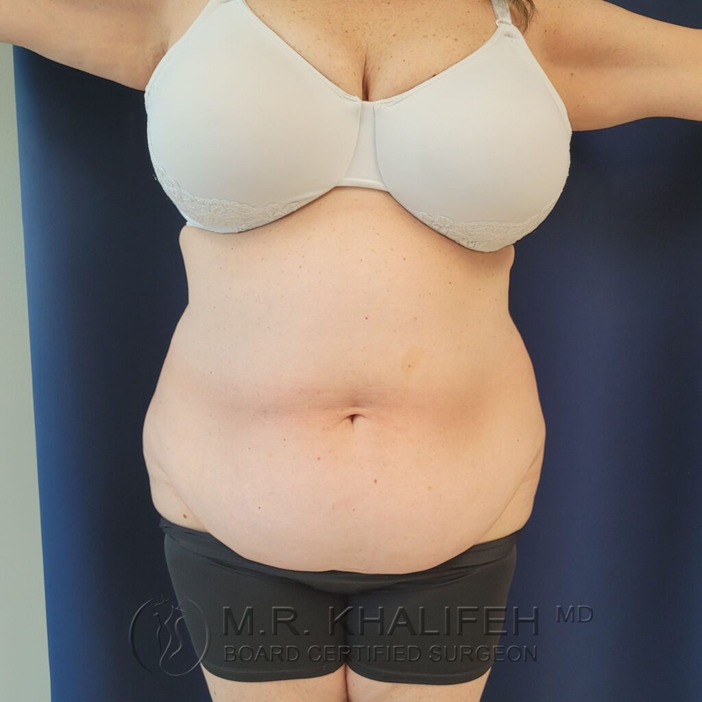 Xr:d:DAFQQTJJlTk:2,j:39259695324,t:22102717