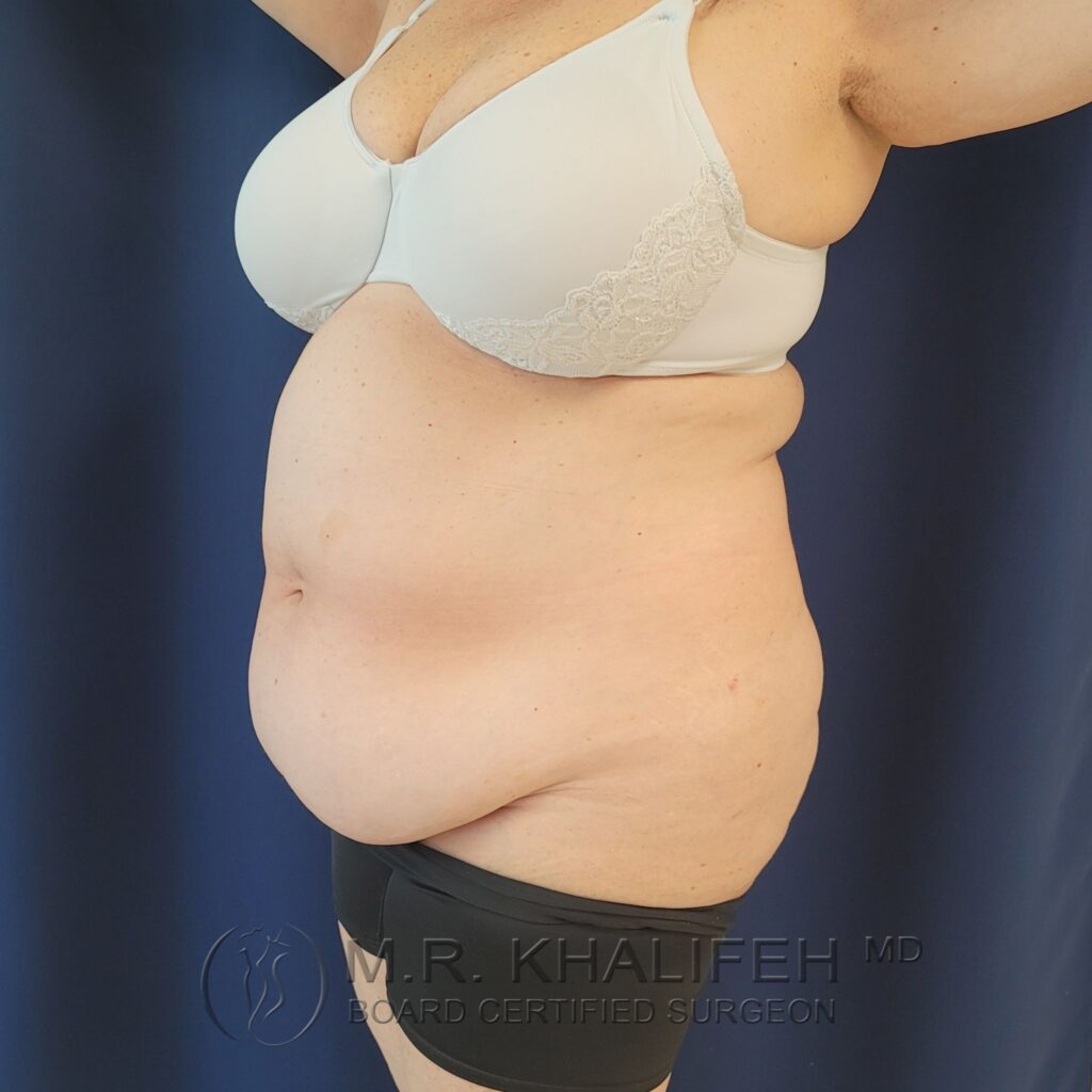 Xr:d:DAFQQV4WPBQ:3,j:39259733910,t:22102717